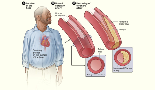 Illustration for article titled What we know now about cholesterol that we didn't 10 years ago
